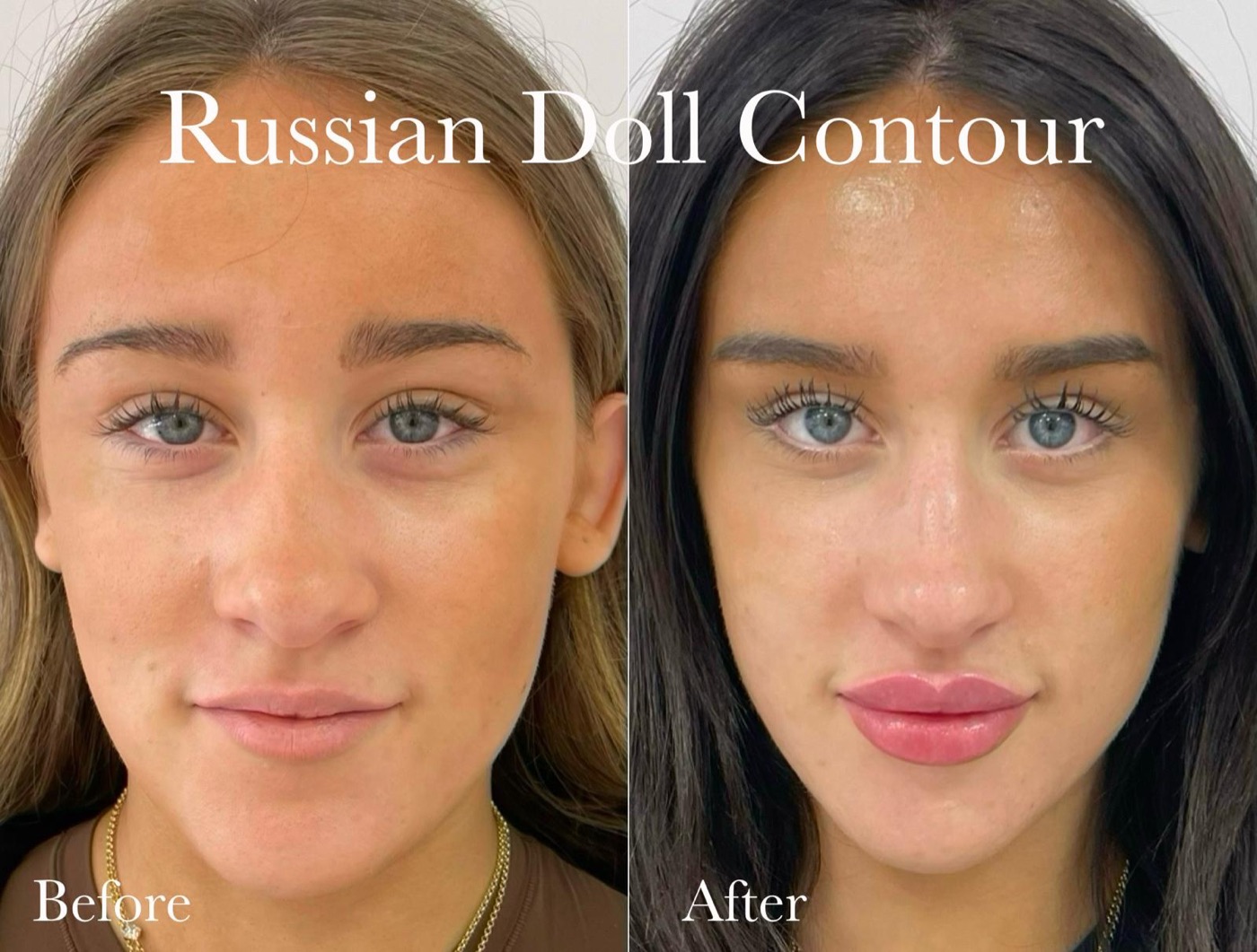 Before and after: Russian doll contour